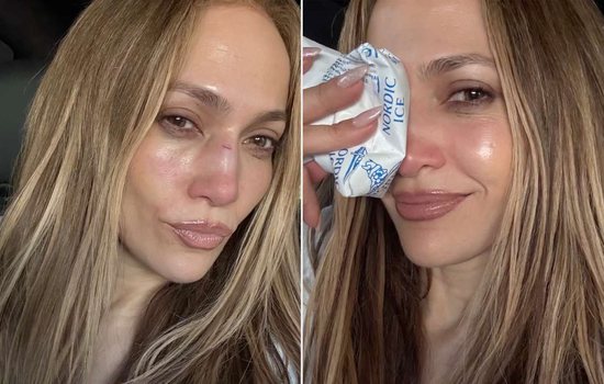 Two weeks before the important event, Jennifer Lopez has an accident on st...
