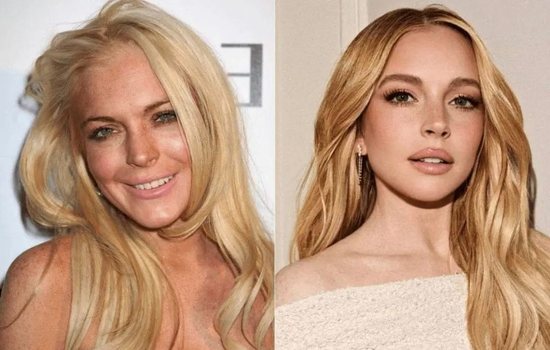 For those who thought she had a facelift: Lindsay Lohan has a super ans...