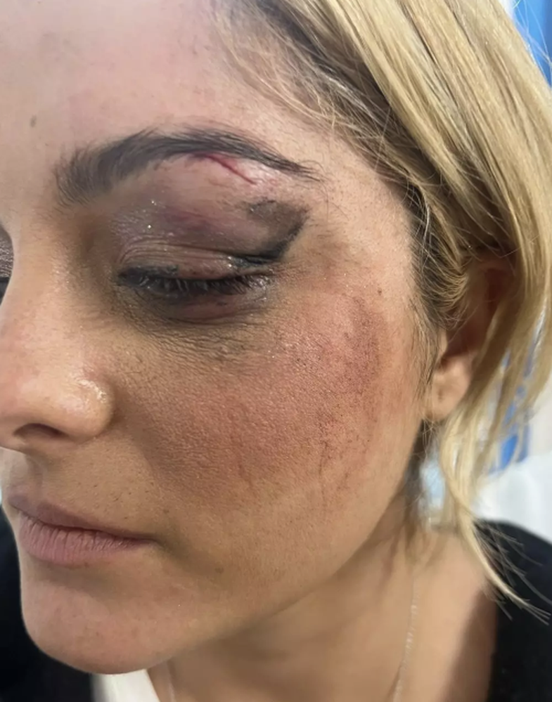 Incidenti në koncert: Bebe Rexha tregon gjendjen, pas arrestimit të