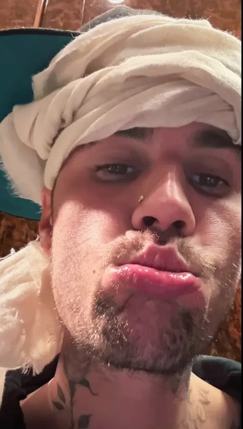 Justin Bieber trondit me deklaratat e radhës, fansat të