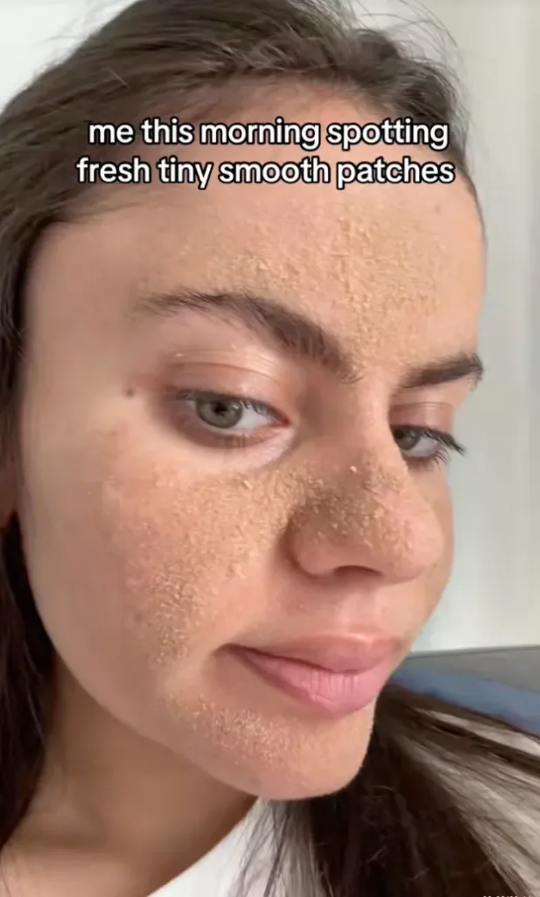 TikTok-u bëri viral "metodën e shpellarit", pa ditur