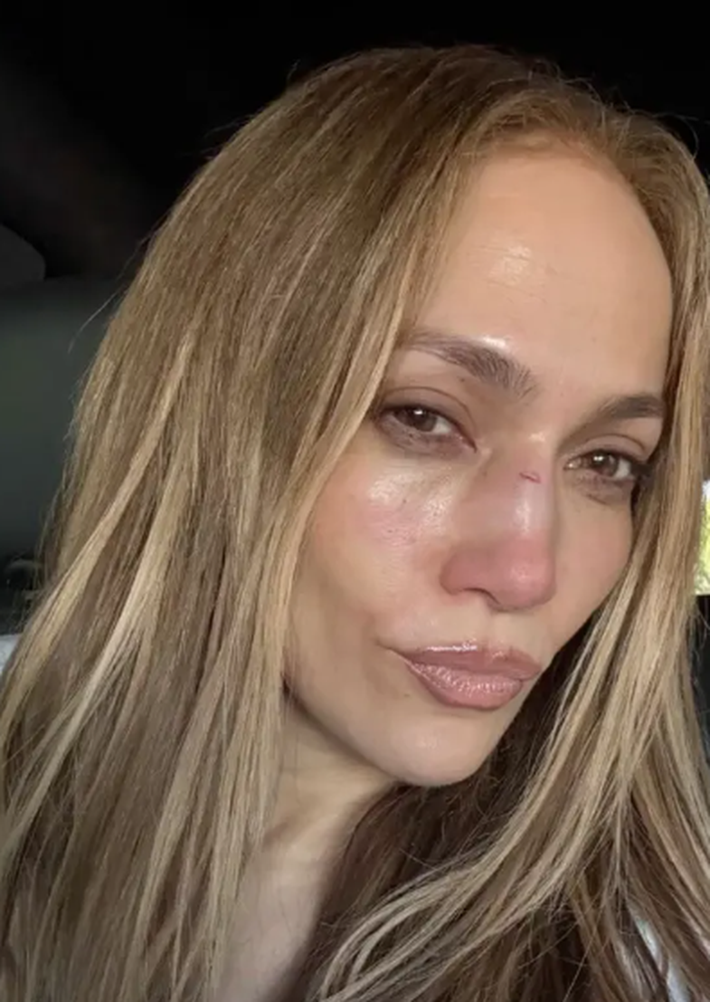 This incident involving J.Lo's outfit would be every woman's nightmare