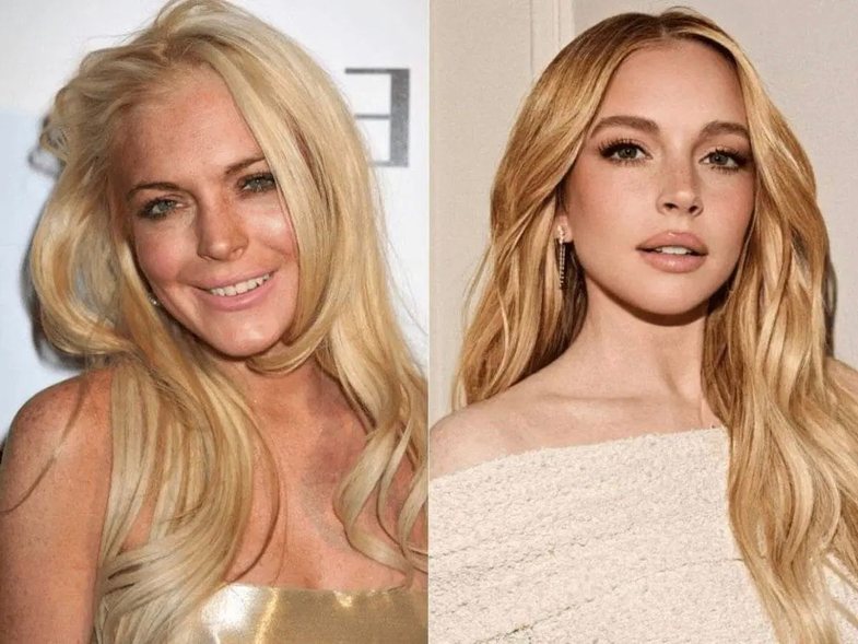 For those who thought she had a facelift: Lindsay Lohan has a super answer