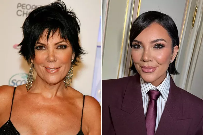 Everything Kris Jenner has revealed about her plastic surgeries over the years